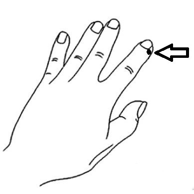 LI-1 Point