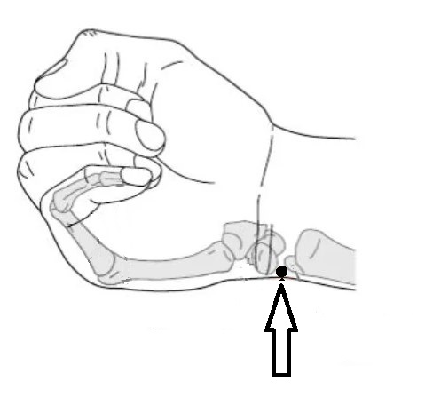 SI-5 Point